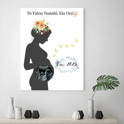 Personalised Ultrasound Frame (A3)